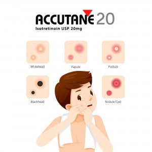 ACCUTANE 20MG/50TABS - STOP ACNE 