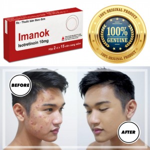 IMANOK 10MG/30CAPS - ACNE CURE IMANOK 10MG/30CAPS - ACNE CURE