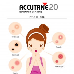 ACCUTANE 20MG/50TABS - STOP ACNE 